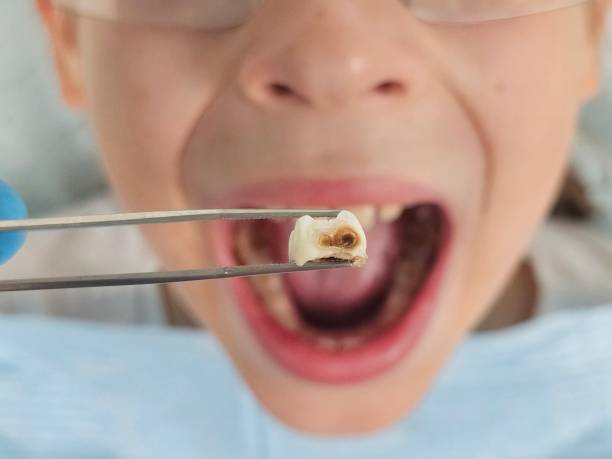 Best Tooth Pain Emergency Relief  in Woodville, MS